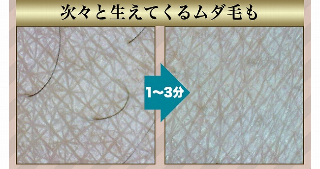���f�B�A�G�X�e���C���o�X�����[�o�[ �摜4